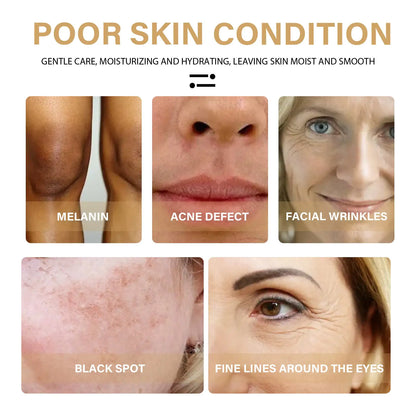 EELHOE Turmeric Dark Spot Correction Face Care Spot Moisturizing And Repairing Skin Tone Serum